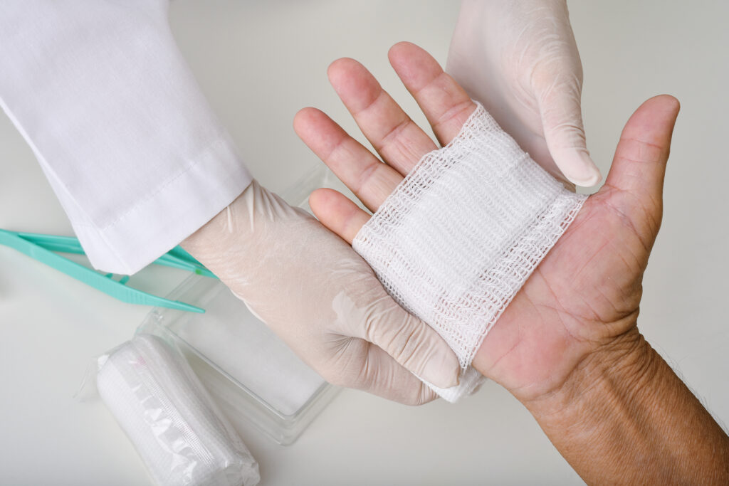 Doctor doing wound dressing care and bandaging patient's hand, Hand surgery treatment, Nurse treat patient's finger injury in hospital.